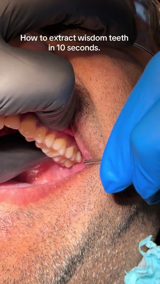 Post 1 by Dr Dalghous on TikTok (video)