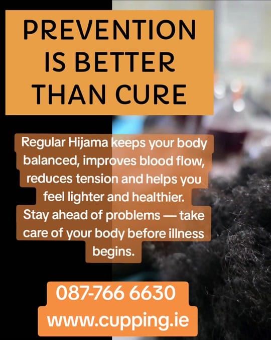 Post 3 by Hijama Therapy 🇮🇪 on TikTok (video)