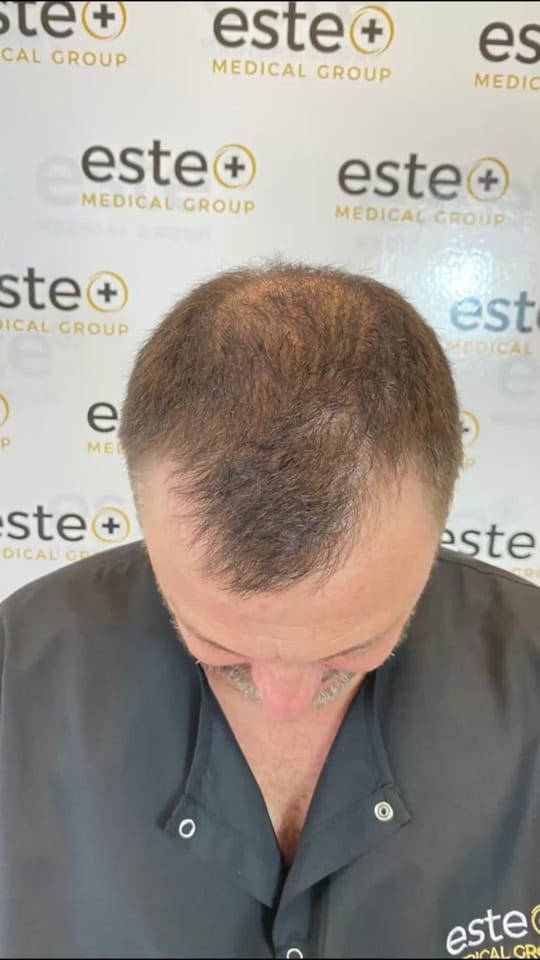 Post 5 by Este Medical Group on TikTok (video)
