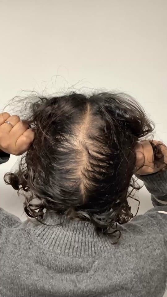 Post 9 by Este Medical Group on TikTok (video)