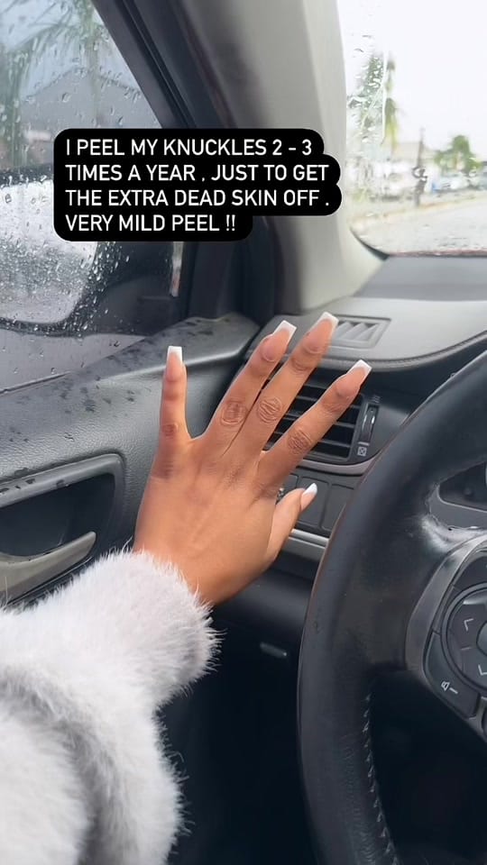 Post 8 by Jaysglam_skin on TikTok (video)