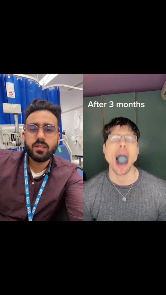 Post 10 by Dr. Onkar | Dentist on TikTok (video)