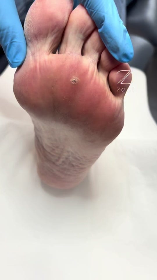 Post 9 by Zest Podiatry on TikTok (video)