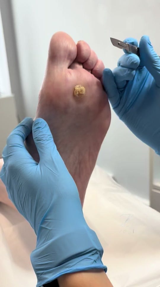 Post 8 by Zest Podiatry on TikTok (video)