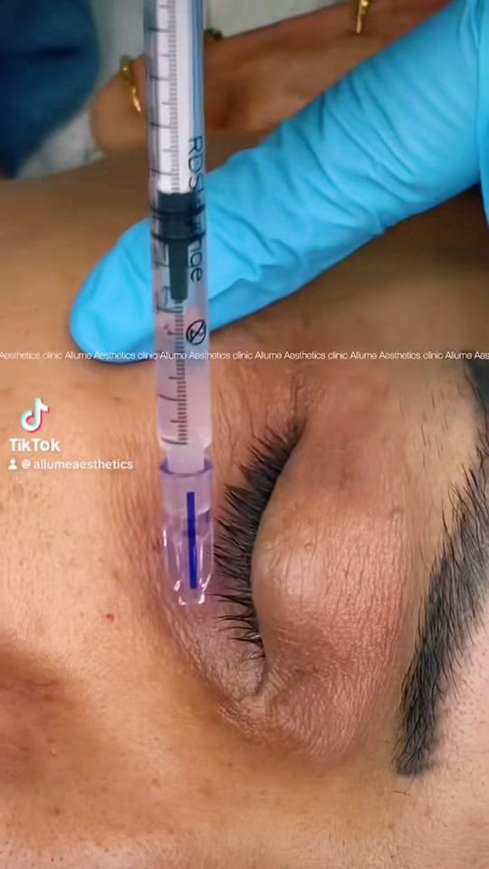 Post 9 by Allume aesthetics on TikTok (video)
