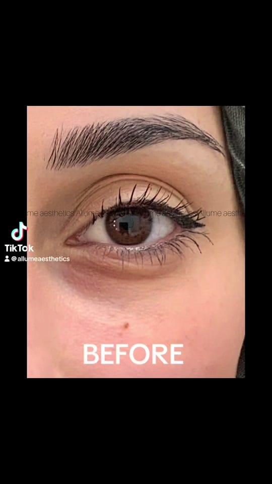 Post 5 by Allume aesthetics on TikTok (video)