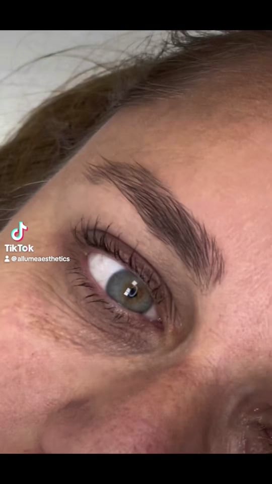 Post 10 by Allume aesthetics on TikTok (video)