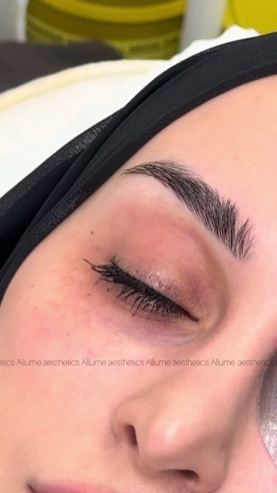 Post 2 by Allume aesthetics on TikTok (video)
