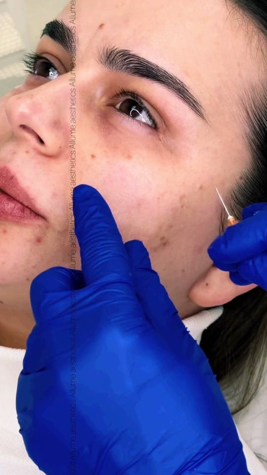 Post 7 by Allume aesthetics on TikTok (video)