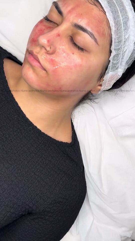 Post 1 by Allume aesthetics on TikTok (video)