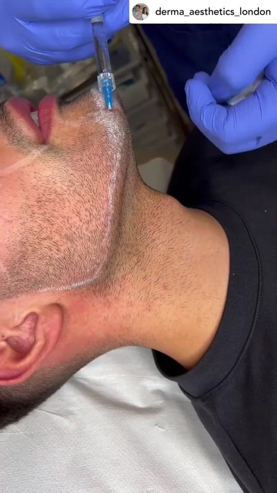 Post 10 by Derma Aesthetics London on TikTok (video)