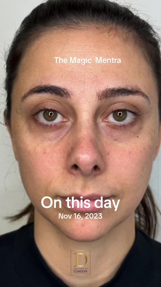 Post 3 by Derma Aesthetics London on TikTok (video)