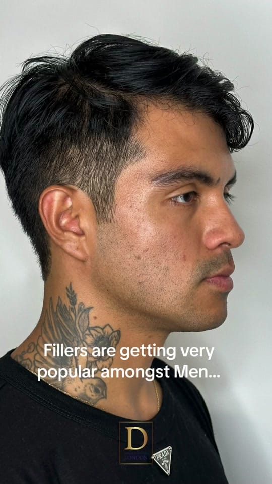 Post 8 by Derma Aesthetics London on TikTok (video)
