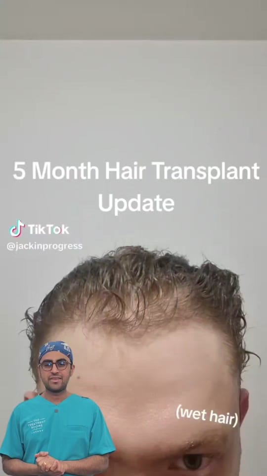 Post 6 by Hair Transplant Clinic on TikTok (video)