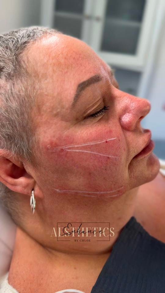 Post 7 by EnhanceAestheticsbychloe on TikTok (video)