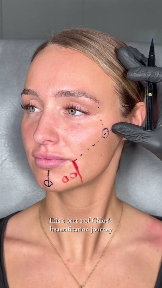 Post 3 by DrMediSpa on TikTok (video)