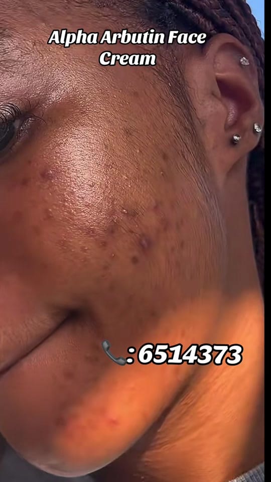 Post 2 by Omar’s Skinplug 🇬🇲 on TikTok (video)