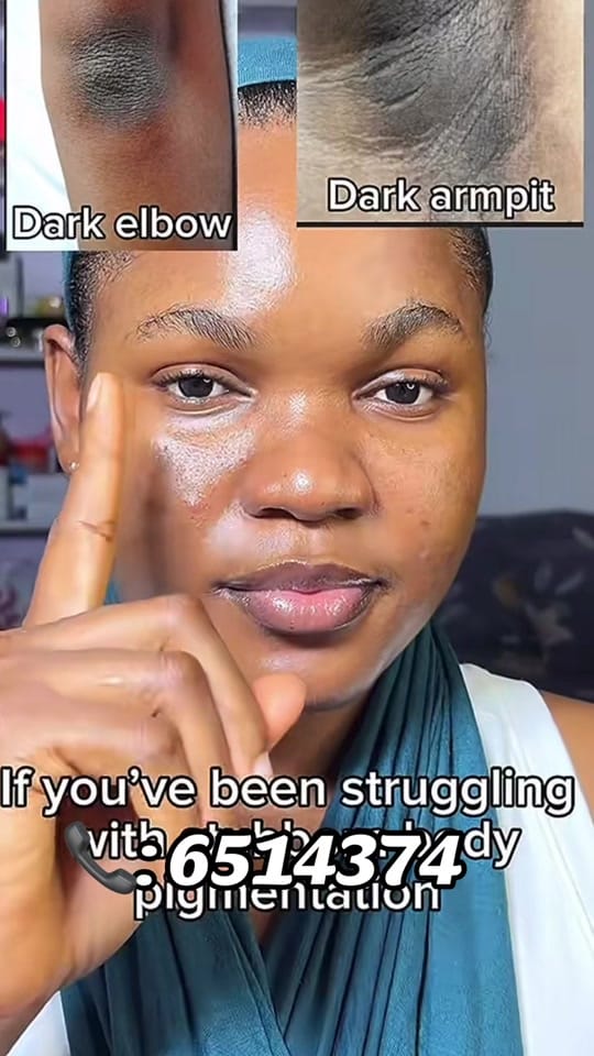 Post 8 by Omar’s Skinplug 🇬🇲 on TikTok (video)