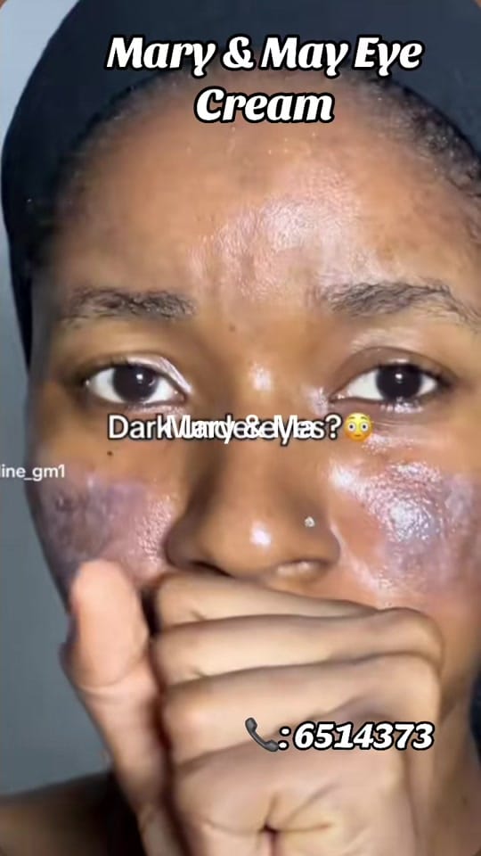Post 5 by Omar’s Skinplug 🇬🇲 on TikTok (video)