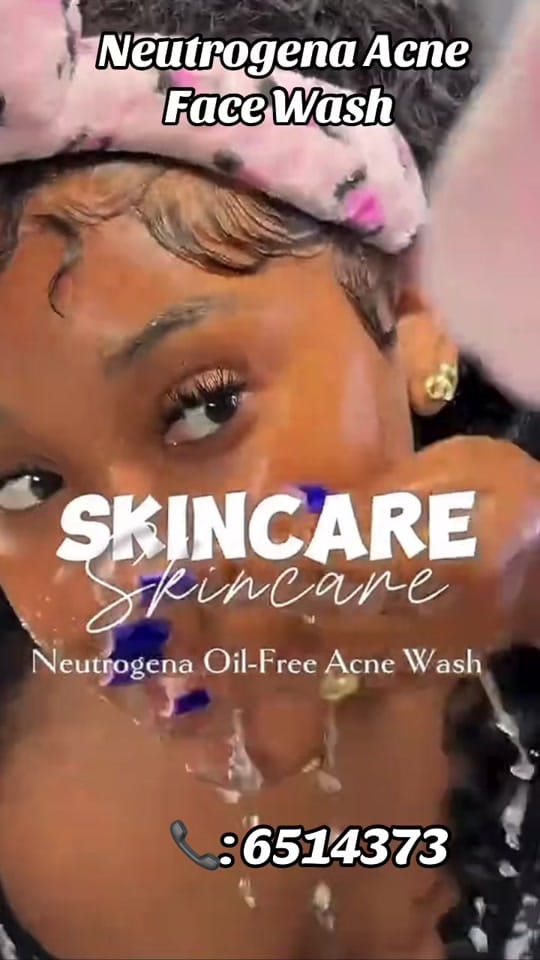 Post 4 by Omar’s Skinplug 🇬🇲 on TikTok (video)