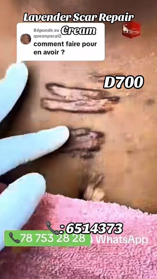 Post 3 by Omar’s Skinplug 🇬🇲 on TikTok (video)