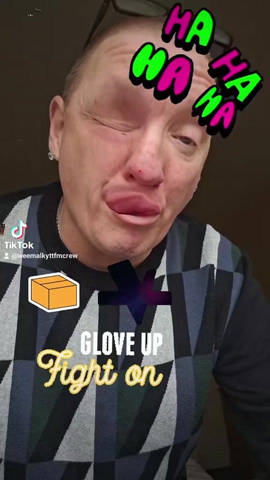 Post 2 by wee malky on TikTok (video)