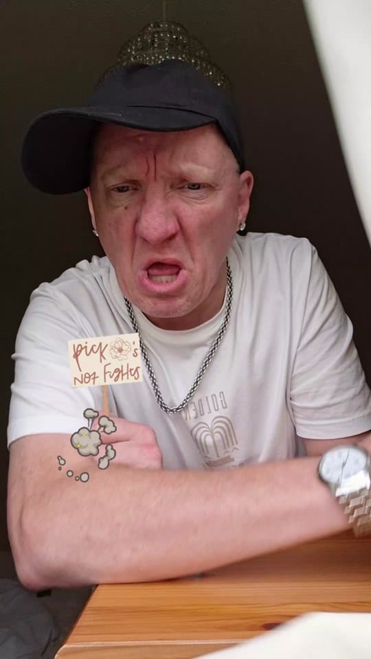 Post 5 by wee malky on TikTok (video)