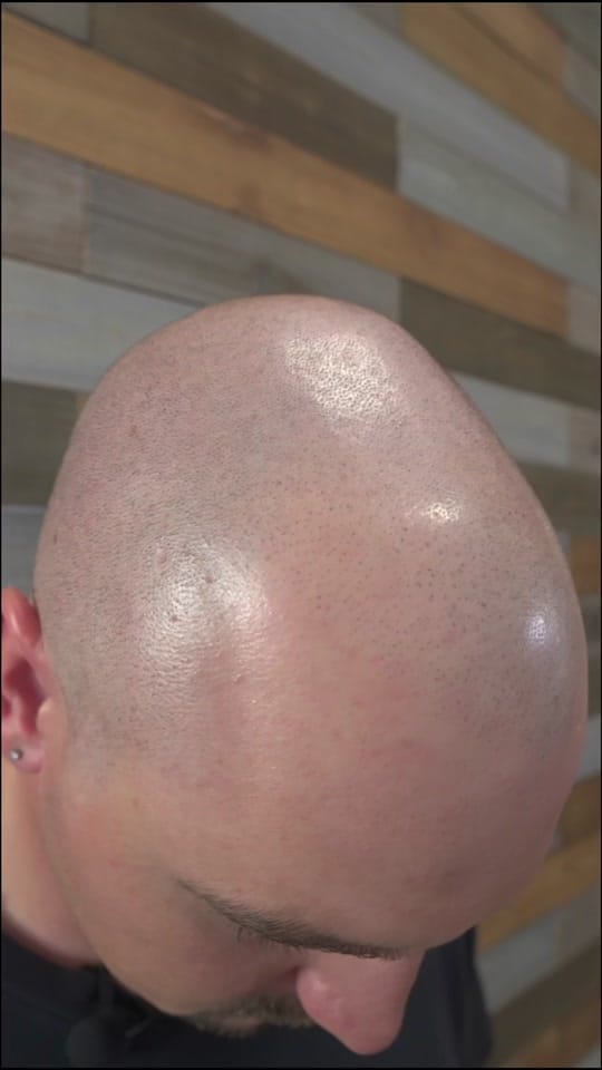 Post 1 by GraigScalpMicro on TikTok (video)