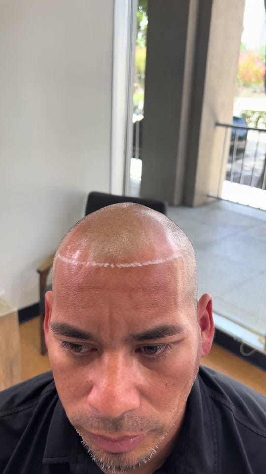 Post 7 by GraigScalpMicro on TikTok (video)