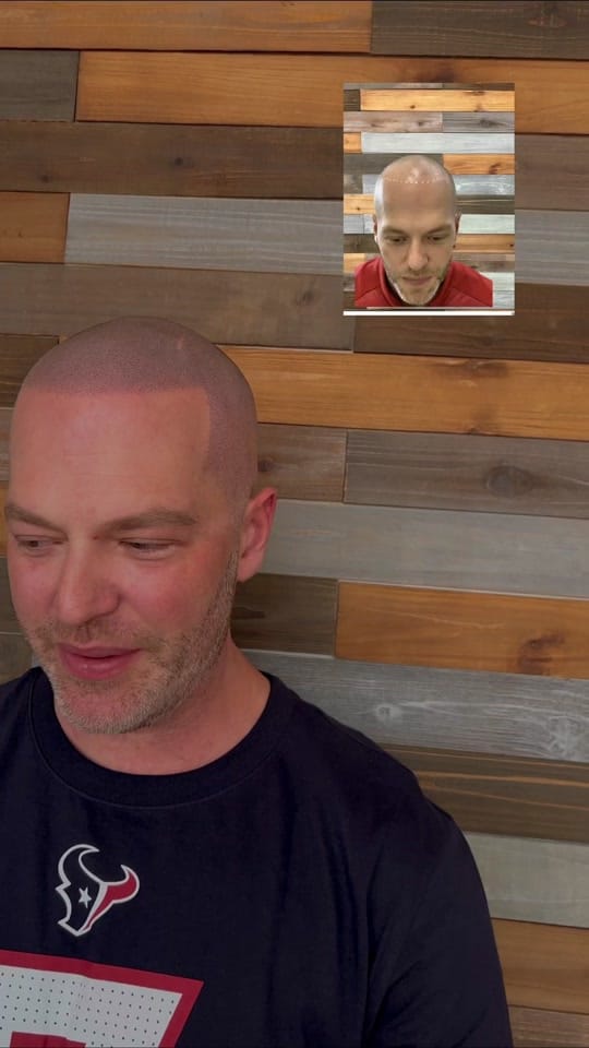 Post 3 by GraigScalpMicro on TikTok (video)