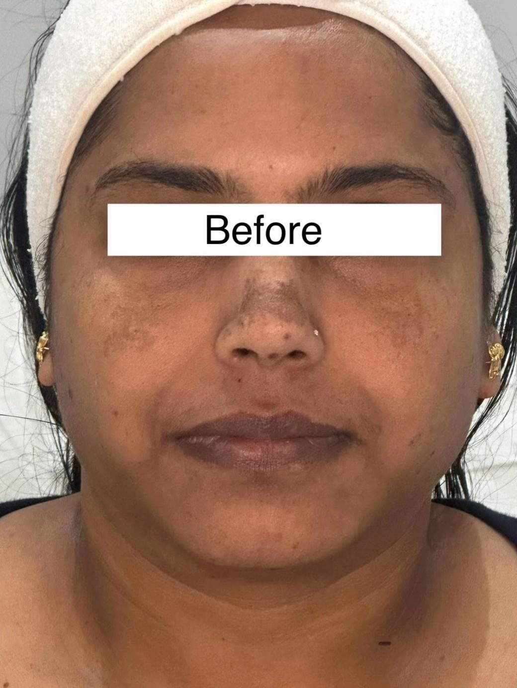 Post 1 by DermAlign Skin & Laser Clinic on TikTok (video)