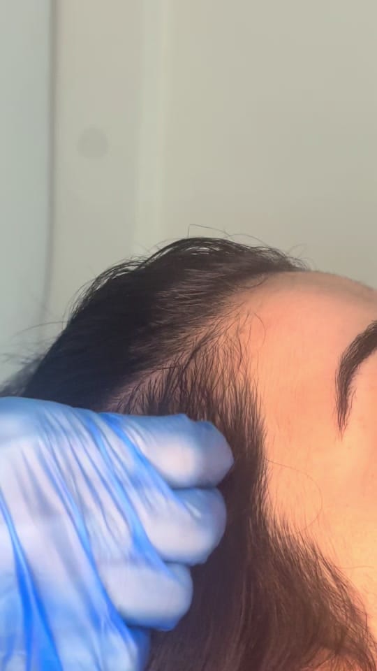 Post 3 by DermAlign Skin & Laser Clinic on TikTok (video)