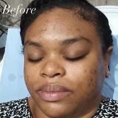 Post 6 by DermAlign Skin & Laser Clinic on TikTok (video)