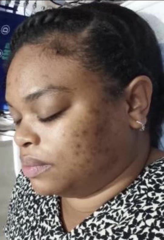 Post 9 by DermAlign Skin & Laser Clinic on TikTok (video)