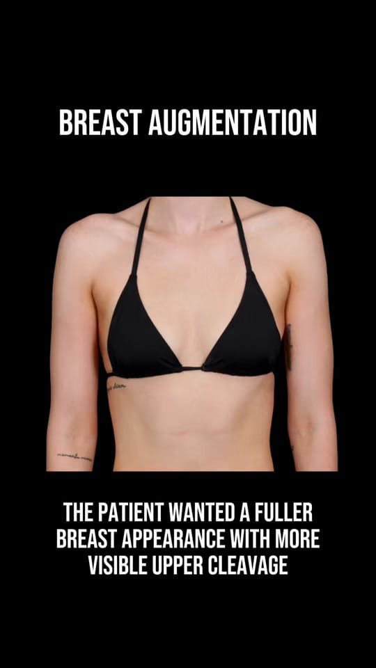 Post 7 by Dr. Christine Fisher, MD, FACS on TikTok (video)