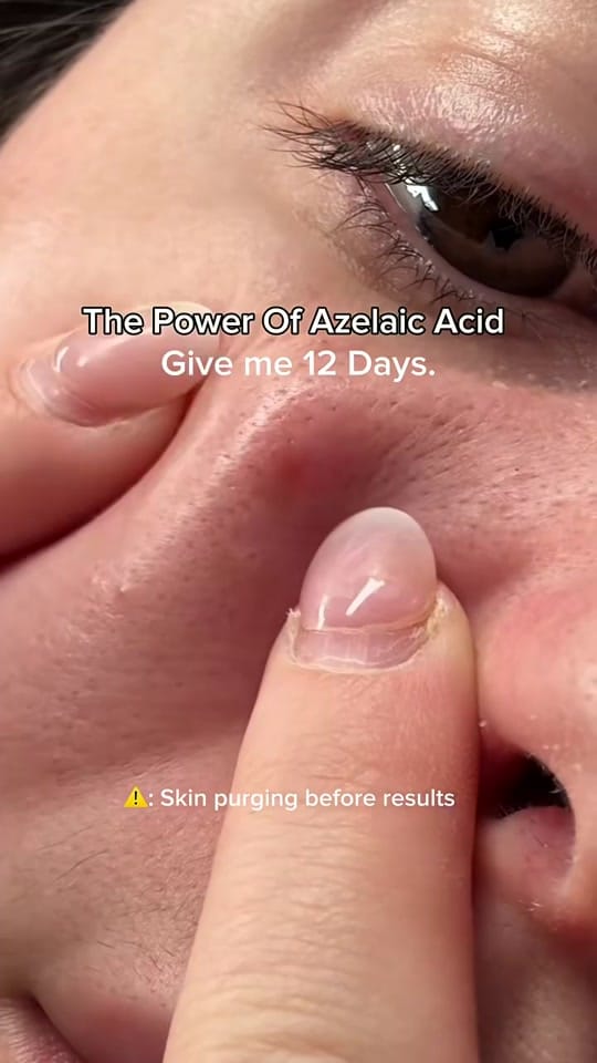 Post 2 by sapience global on TikTok (video)