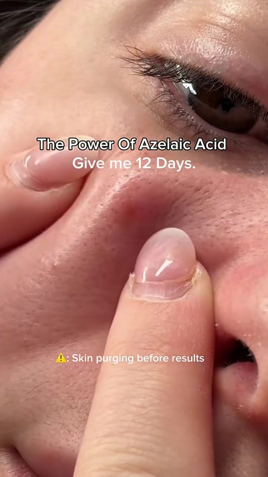 Post 1 by sapience global on TikTok (video)