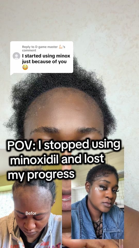Post 6 by Vicouch 🇳🇬🇩🇪 on TikTok (video)
