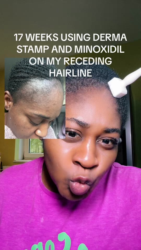 Post 10 by Vicouch 🇳🇬🇩🇪 on TikTok (video)