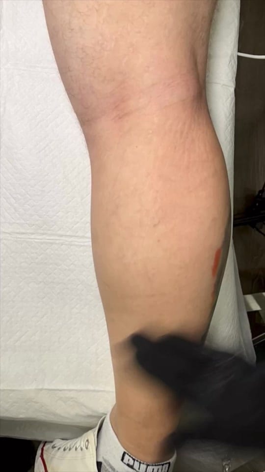 Post 5 by nestor  palacios on TikTok (video)