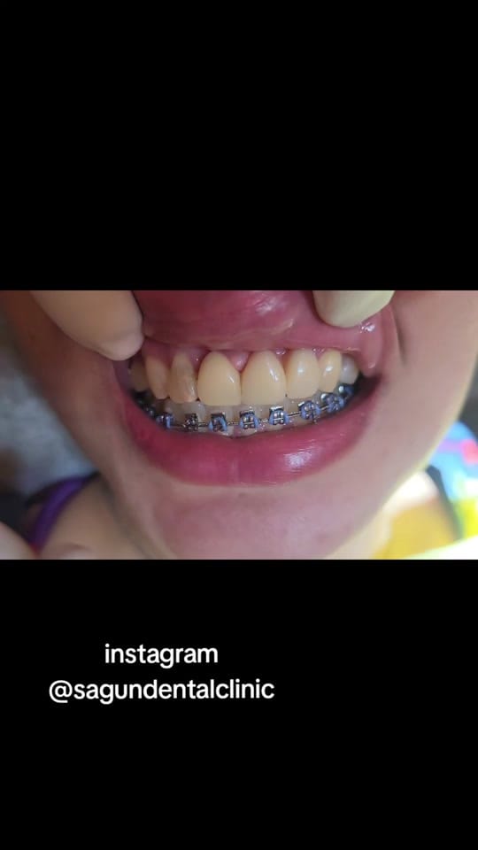 Post 10 by Marie Faith Sagun Dmd on TikTok (video)