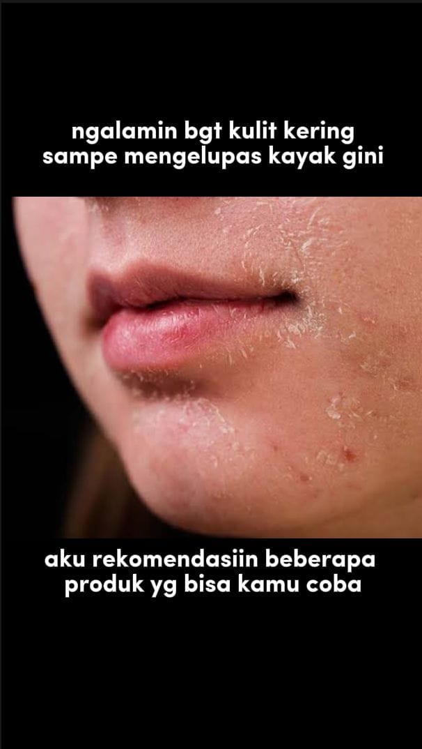 Post 10 by irmalisdamayanti on TikTok (video)