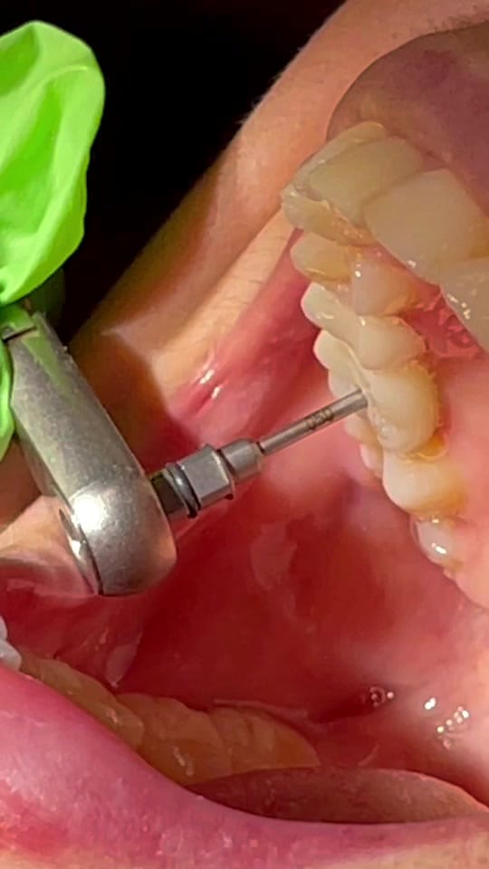 Post 10 by Affordable Dentistry of SFL on TikTok (video)