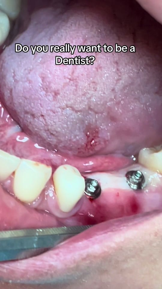 Post 4 by CC Dentistree on TikTok (video)