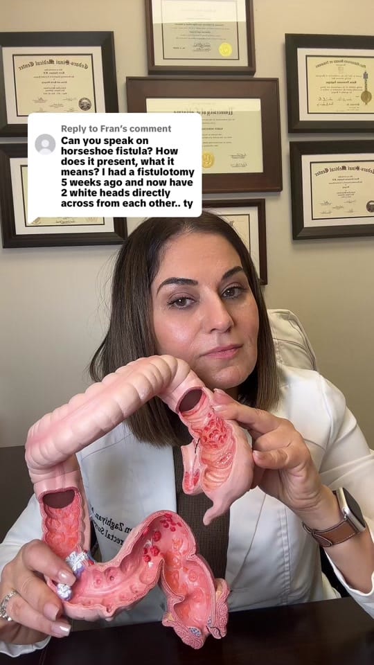 Post 2 by Karen Zaghiyan, MD, FASCRS on TikTok (video)