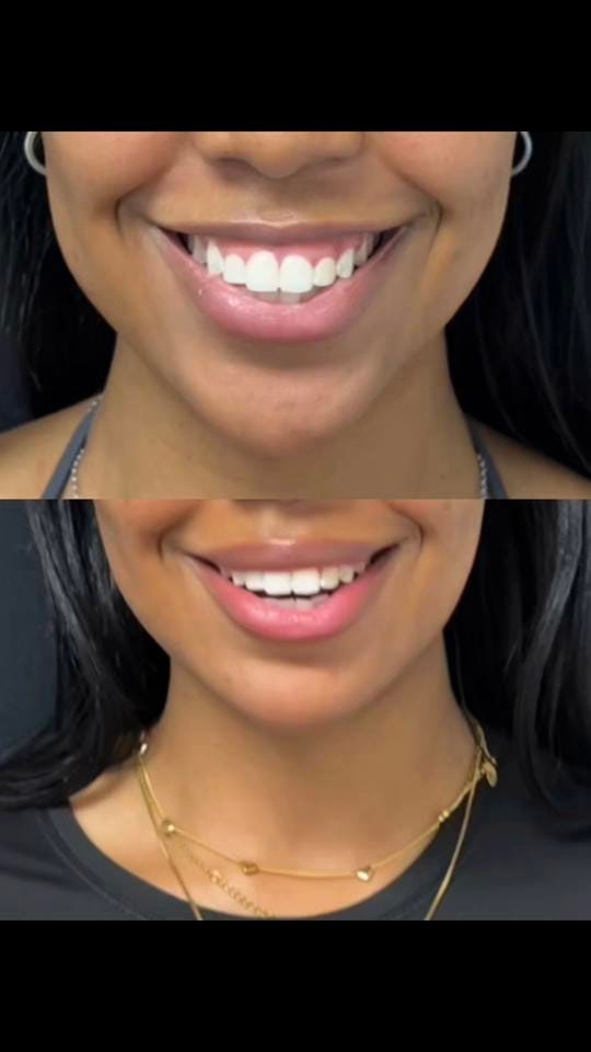 Post 4 by Eugenia | Dallas Injector on TikTok (video)