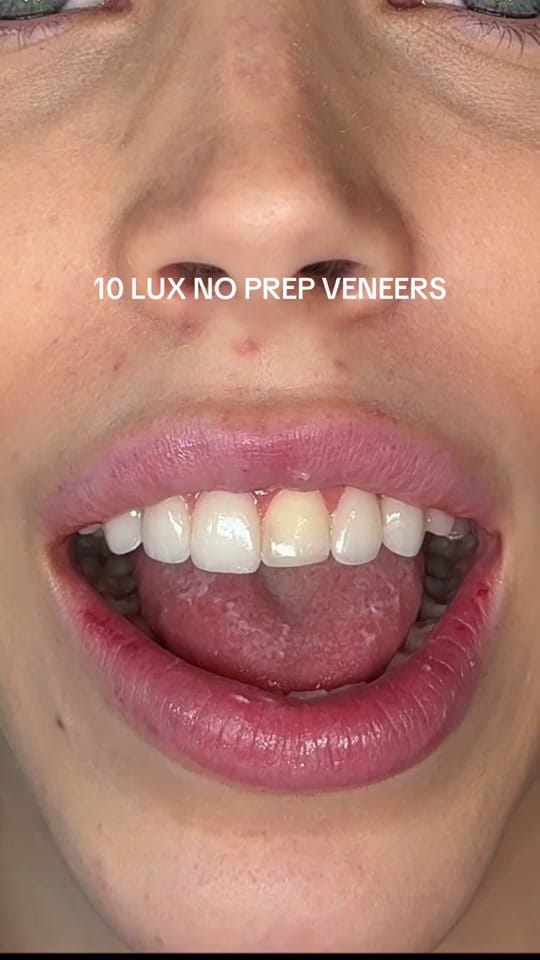 Post 10 by drjamesheaton on TikTok (video)