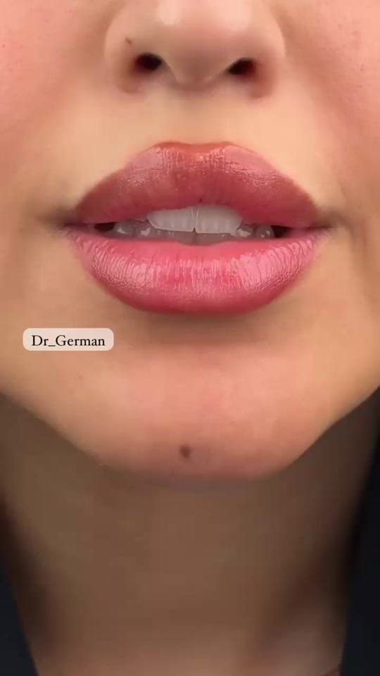 Post 4 by Dr_German on TikTok (video)
