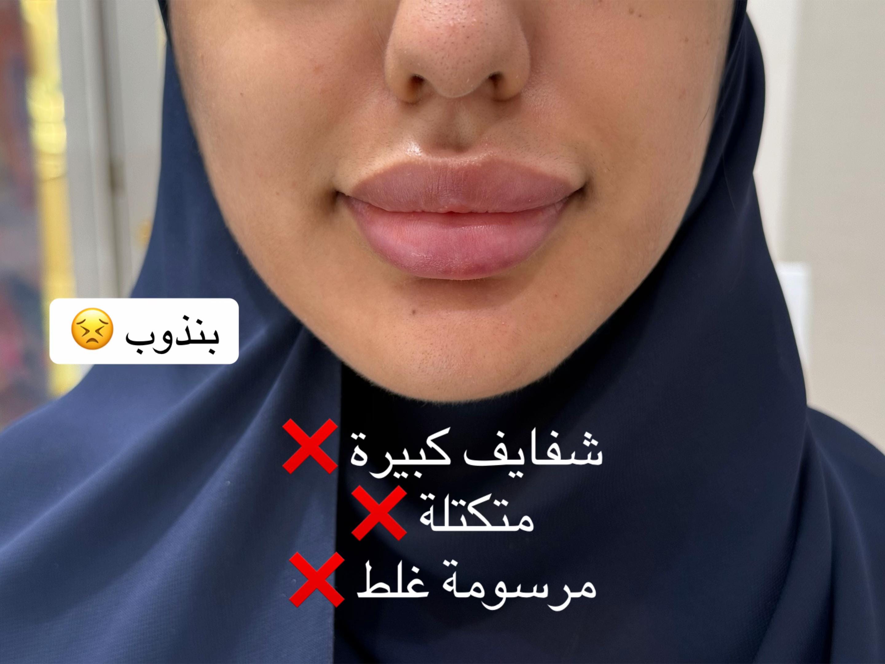 Post 9 by Dr.Lama.Kayali on TikTok (video)