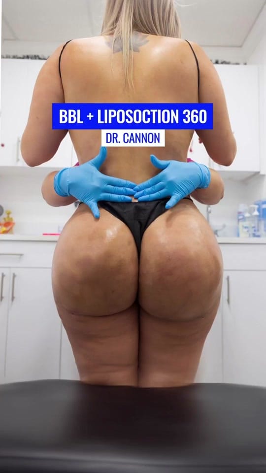 Post 4 by Dr. Cliff Cannon, MD on TikTok (video)